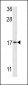 APG8b (MAP1LC3B)-T93/Y99  Antibody (Center)